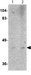 Western blot - Anti-LASS6/CERS6 antibody (AB115539)