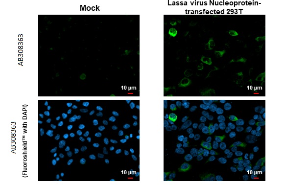 Immunocytochemistry/ Immunofluorescence - Anti-Lassa virus Nucleoprotein antibody [HL1392] (AB308363), expandable thumbnail