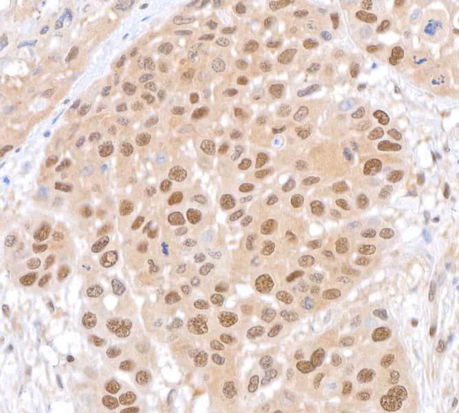Immunohistochemistry (Formalin/PFA-fixed paraffin-embedded sections) - Anti-Lasu1/Ureb1 antibody [BLR129H] - BSA free (ab314065), expandable thumbnail