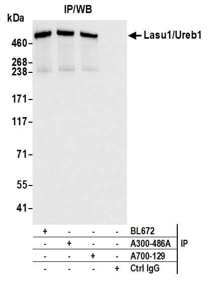 Immunoprecipitation - Anti-Lasu1/Ureb1 antibody [BLR129H] - BSA free (AB314065)