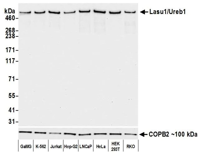 Western blot - Anti-Lasu1/Ureb1 antibody [BLR129H] - BSA free (AB314065)