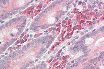 Immunohistochemistry (Formalin/PFA-fixed paraffin-embedded sections) - Anti-LAT antibody (AB189105)