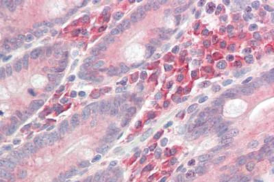 Immunohistochemistry (Formalin/PFA-fixed paraffin-embedded sections) - Anti-LAT antibody (AB189105)