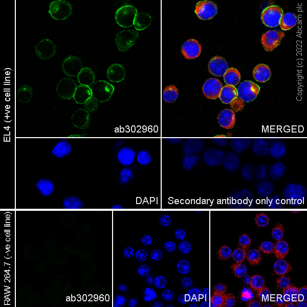 Immunocytochemistry/ Immunofluorescence - Anti-LAT antibody [EPR26091-2] (AB302960), expandable thumbnail