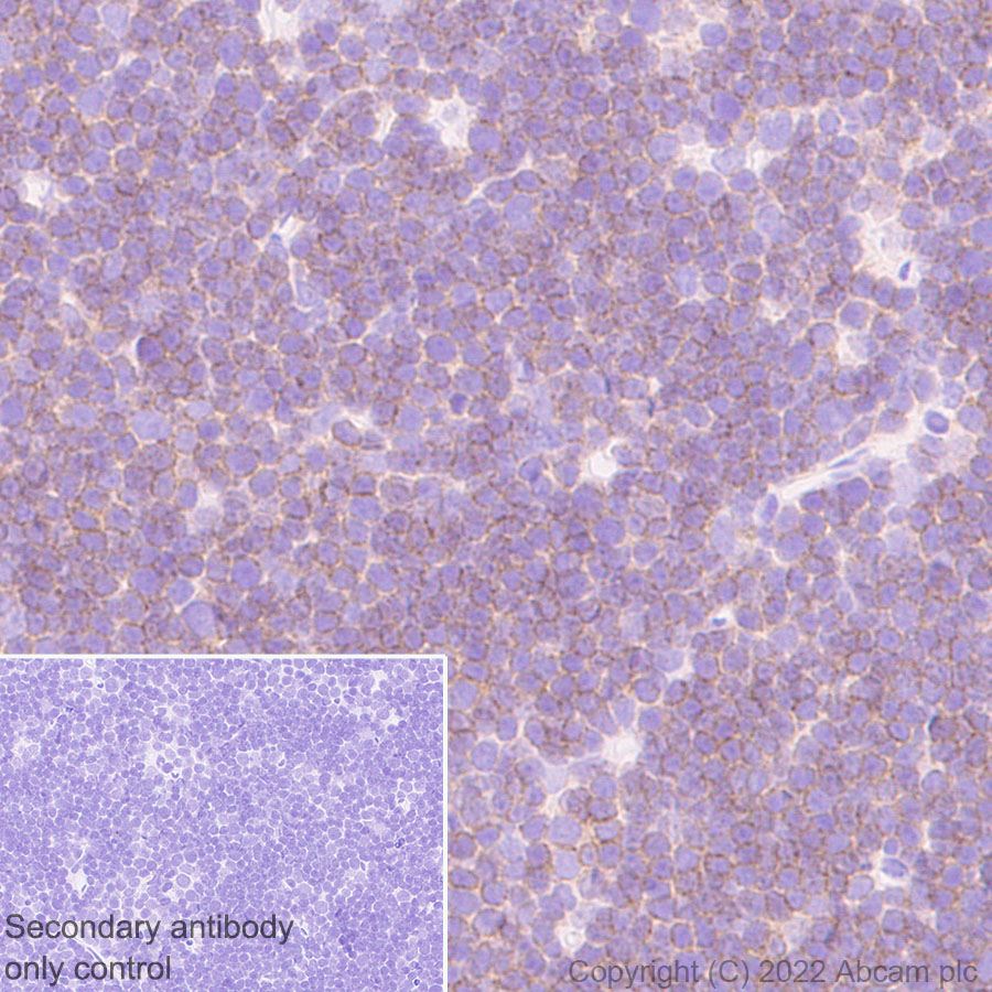 Immunohistochemistry (Formalin/PFA-fixed paraffin-embedded sections) - Anti-LAT antibody [EPR26091-2] (AB302960), expandable thumbnail