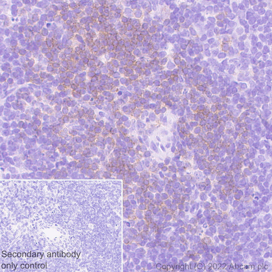 Immunohistochemistry (Formalin/PFA-fixed paraffin-embedded sections) - Anti-LAT antibody [EPR26091-2] (AB302960), expandable thumbnail