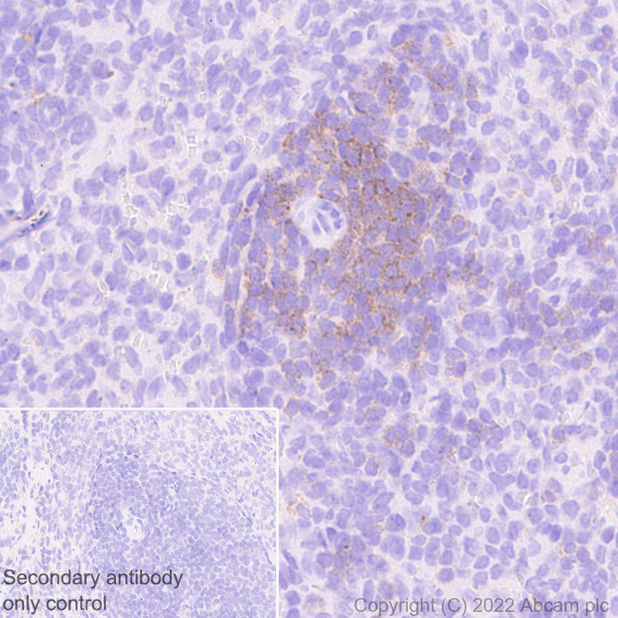 Immunohistochemistry (Formalin/PFA-fixed paraffin-embedded sections) - Anti-LAT antibody [EPR26091-2] (AB302960), expandable thumbnail