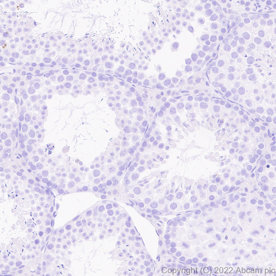 Immunohistochemistry (Formalin/PFA-fixed paraffin-embedded sections) - Anti-LAT antibody [EPR26091-2] (AB302960), expandable thumbnail