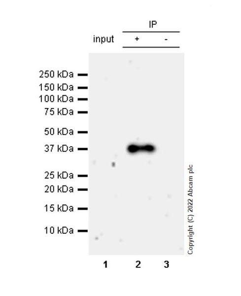 Immunoprecipitation - Anti-LAT antibody [EPR26091-2] (ab302960), expandable thumbnail