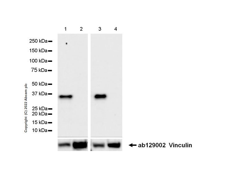 Western blot - Anti-LAT antibody [EPR26091-2] (ab302960), expandable thumbnail