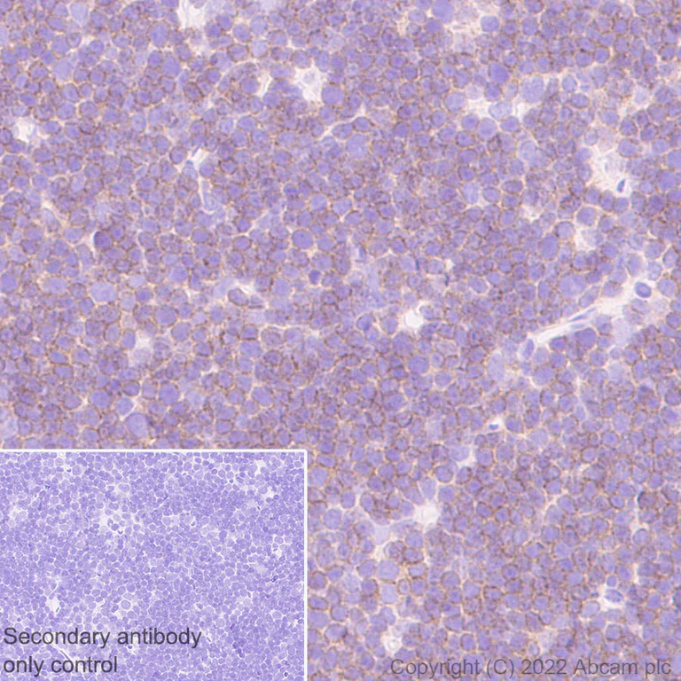 Immunohistochemistry (Formalin/PFA-fixed paraffin-embedded sections) - Anti-LAT antibody [EPR26091-2] - BSA and Azide free (AB302961)