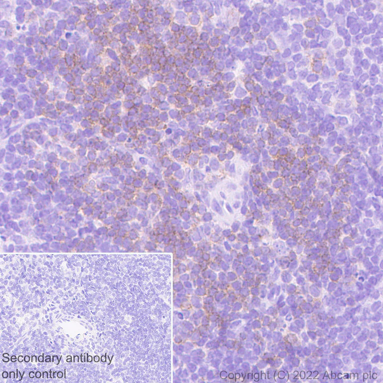 Immunohistochemistry (Formalin/PFA-fixed paraffin-embedded sections) - Anti-LAT antibody [EPR26091-2] - BSA and Azide free (AB302961)