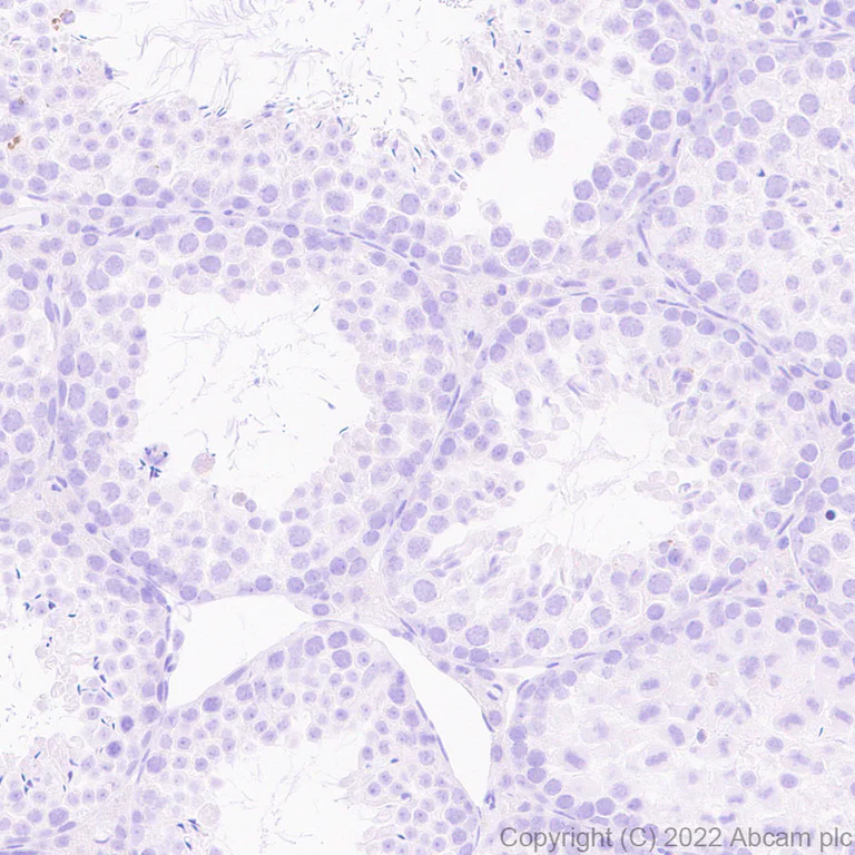 Immunohistochemistry (Formalin/PFA-fixed paraffin-embedded sections) - Anti-LAT antibody [EPR26091-2] - BSA and Azide free (AB302961)