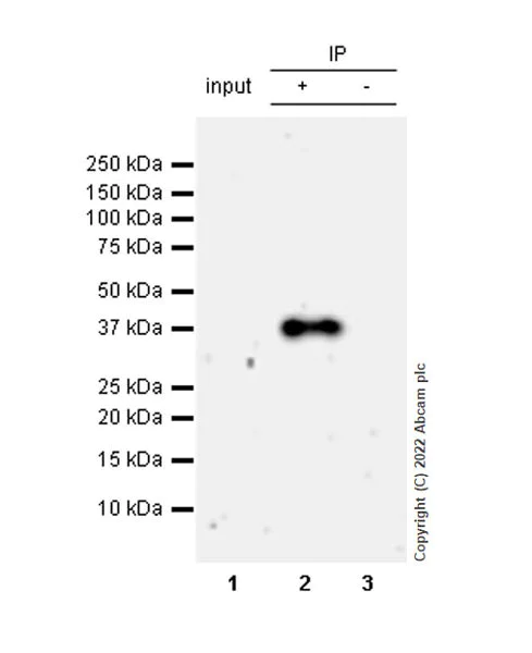 Immunoprecipitation - Anti-LAT antibody [EPR26091-2] - BSA and Azide free (AB302961)