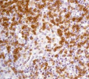 Immunohistochemistry (Formalin/PFA-fixed paraffin-embedded sections) - Anti-LAT antibody [Y109] (AB32070)