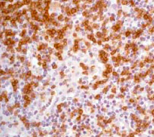 Immunohistochemistry (Formalin/PFA-fixed paraffin-embedded sections) - Anti-LAT antibody [Y109] - BSA and Azide free (AB247221)
