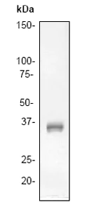 Western blot - Anti-LAT antibody [Y109] - BSA and Azide free (AB247221)