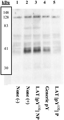 Western blot - Anti-LAT (phospho Y132) antibody (AB4476)