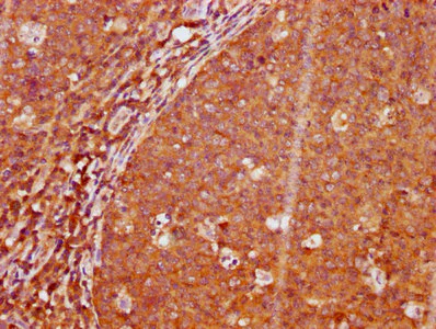 Immunohistochemistry (Formalin/PFA-fixed paraffin-embedded sections) - Anti-LAT (phospho Y191) antibody [2E4] (AB314040)