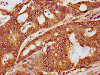 Immunohistochemistry (Formalin/PFA-fixed paraffin-embedded sections) - Anti-LAT (phospho Y191) antibody [2E4] (AB314040)