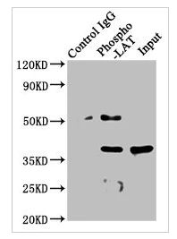 Immunoprecipitation - Anti-LAT (phospho Y191) antibody [2E4] (AB314040)
