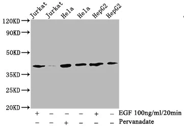 Western blot - Anti-LAT (phospho Y191) antibody [2E4] (AB314040)