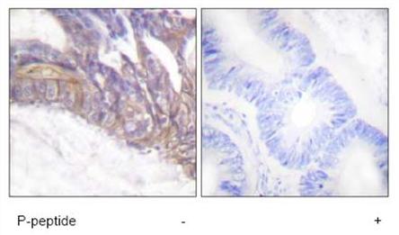 Immunohistochemistry (Formalin/PFA-fixed paraffin-embedded sections) - Anti-LAT (phospho Y191) antibody (AB59197)