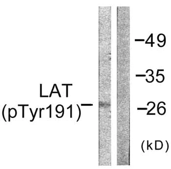 Western blot - Anti-LAT (phospho Y191) antibody (AB59197)