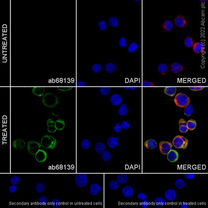 Immunocytochemistry/ Immunofluorescence - Anti-LAT (phospho Y200) antibody [EP983(2)Y] (AB68139), expandable thumbnail