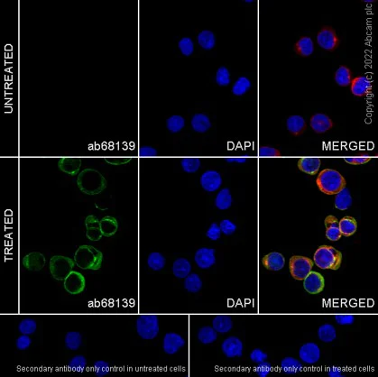Immunocytochemistry/ Immunofluorescence - Anti-LAT (phospho Y200) antibody [EP983(2)Y] (AB68139)