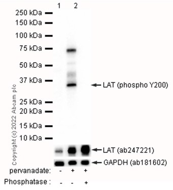 Western blot - Anti-LAT (phospho Y200) antibody [EP983(2)Y] (AB68139), expandable thumbnail