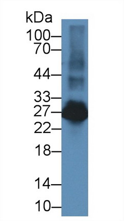 Western blot - Anti-LAT2 antibody (AB233088)