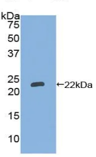 Western blot - Anti-LAT2 antibody (AB233088)