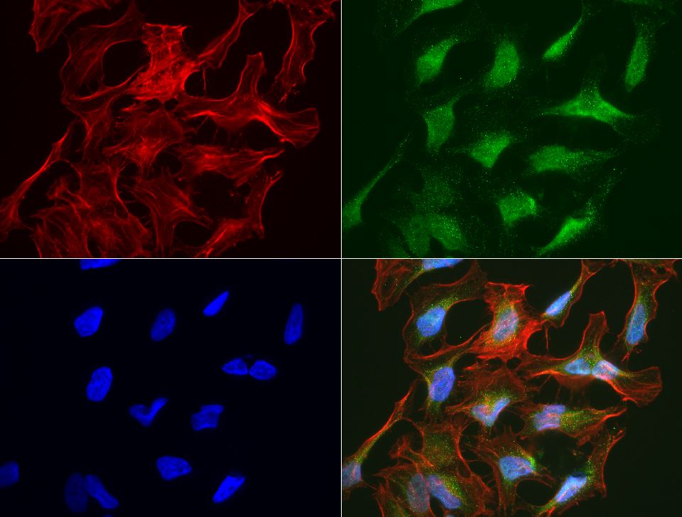 Immunocytochemistry/ Immunofluorescence - Anti-LAT2 antibody [UMAB70] - BSA and Azide free (AB273674), expandable thumbnail