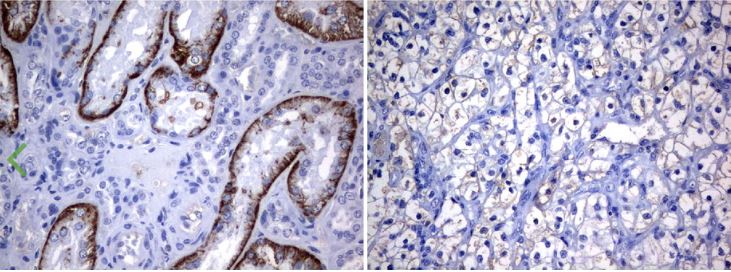 Immunohistochemistry (Formalin/PFA-fixed paraffin-embedded sections) - Anti-LAT2 antibody [UMAB70] - BSA and Azide free (AB273674), expandable thumbnail