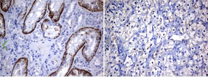 Immunohistochemistry (Formalin/PFA-fixed paraffin-embedded sections) - Anti-LAT2 antibody [UMAB70] - BSA and Azide free (AB273674)