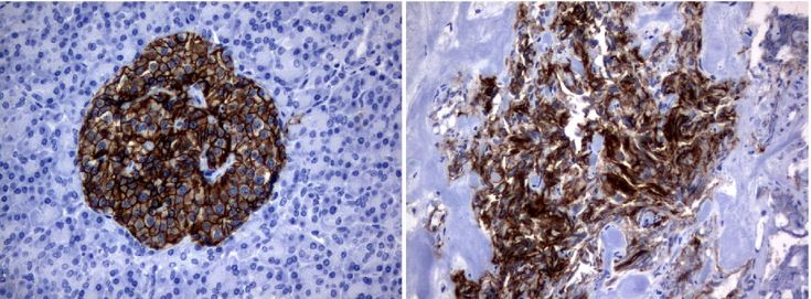 Immunohistochemistry (Formalin/PFA-fixed paraffin-embedded sections) - Anti-LAT2 antibody [UMAB70] - BSA and Azide free (AB273674), expandable thumbnail