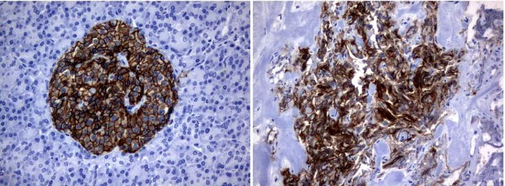 Immunohistochemistry (Formalin/PFA-fixed paraffin-embedded sections) - Anti-LAT2 antibody [UMAB70] - BSA and Azide free (AB273674)