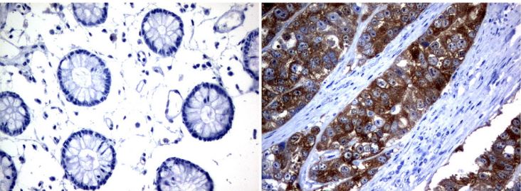 Immunohistochemistry (Formalin/PFA-fixed paraffin-embedded sections) - Anti-LAT2 antibody [UMAB70] - BSA and Azide free (AB273674), expandable thumbnail
