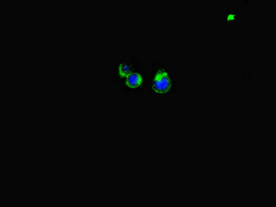 Immunocytochemistry/ Immunofluorescence - Anti-LATS1/WARTS antibody (AB234820)