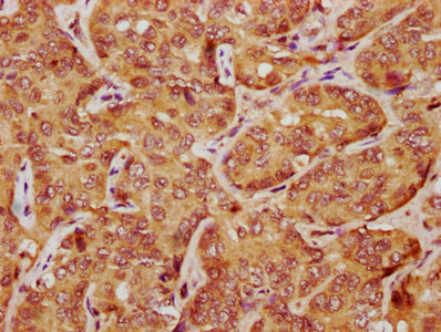 Immunohistochemistry (Formalin/PFA-fixed paraffin-embedded sections) - Anti-LATS1/WARTS antibody (AB234820), expandable thumbnail
