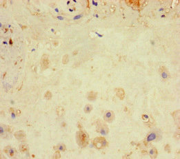 Immunohistochemistry (Formalin/PFA-fixed paraffin-embedded sections) - Anti-LATS1/WARTS antibody (AB234820), expandable thumbnail