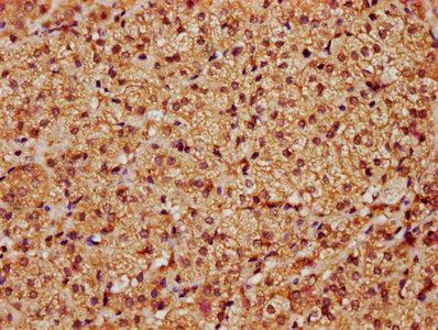Immunohistochemistry (Formalin/PFA-fixed paraffin-embedded sections) - Anti-LATS1/WARTS antibody (ab234820), expandable thumbnail