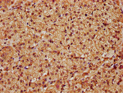 Immunohistochemistry (Formalin/PFA-fixed paraffin-embedded sections) - Anti-LATS1/WARTS antibody (AB234820)