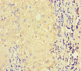 Immunohistochemistry (Formalin/PFA-fixed paraffin-embedded sections) - Anti-LATS1/WARTS antibody (AB234820), expandable thumbnail