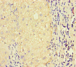Immunohistochemistry (Formalin/PFA-fixed paraffin-embedded sections) - Anti-LATS1/WARTS antibody (AB234820)
