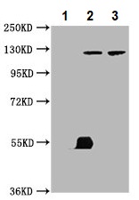 Immunoprecipitation - Anti-LATS1/WARTS antibody (AB234820), expandable thumbnail