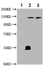 Immunoprecipitation - Anti-LATS1/WARTS antibody (AB234820)