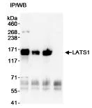 Immunoprecipitation - Anti-LATS1/WARTS antibody (AB70561)