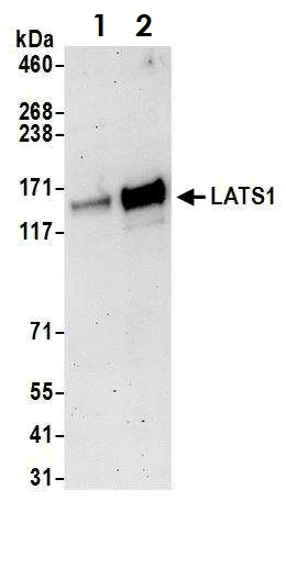 Western blot - Anti-LATS1/WARTS antibody (AB70561)